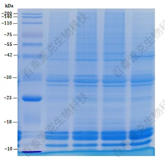 histone-protein-extraction-kit