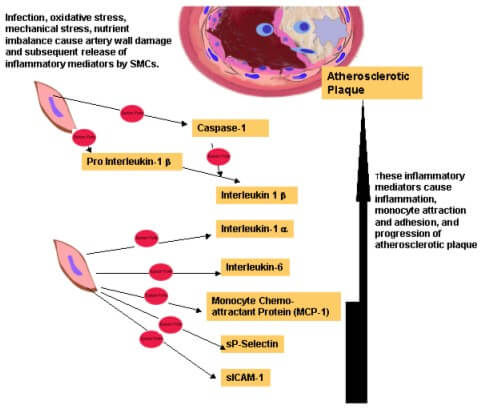 20221219-3099-CardiovascularDiseases心血管疾病－流式细胞因子检测.jpg