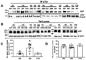 20221219-9155-在AD患者神经元中淀粉样前体蛋白在Tyr残基处被磷酸化.png